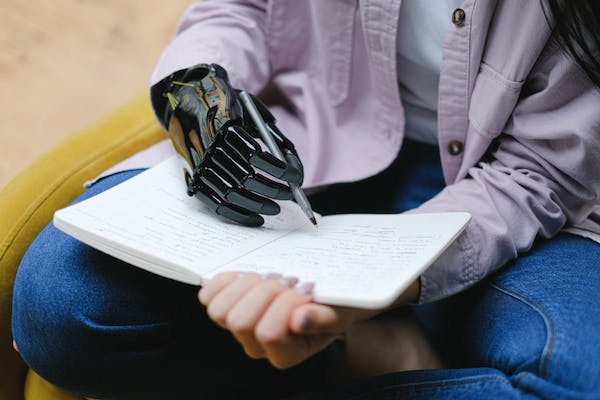 Prosthetic hand